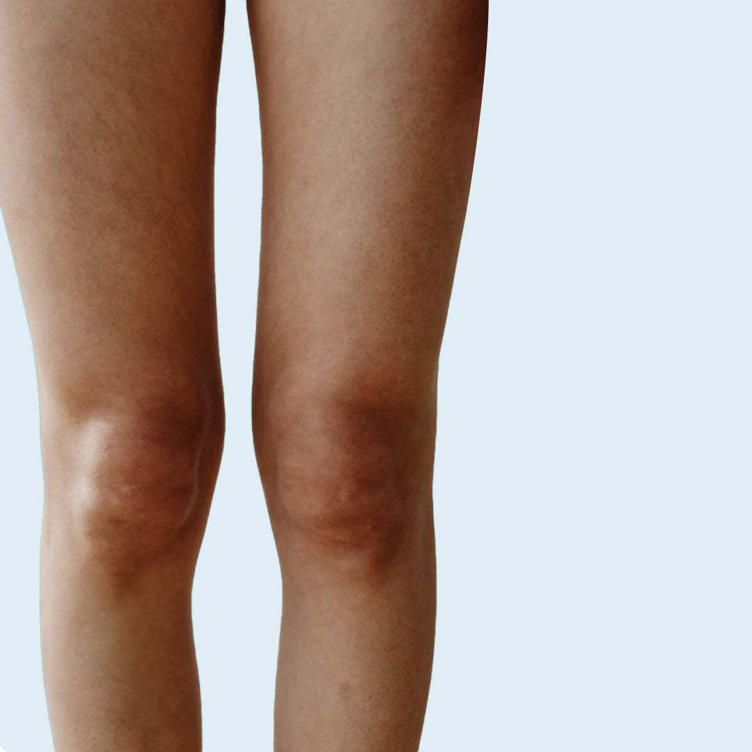 Jambes lourdes